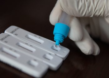 Τα σημεία του ΕΟΔΥ για δωρεάν rapid test τη Δευτέρα 23 Οκτωβρίου – FANTOMAS.GR