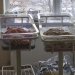 Αυστραλία: Σπάνιο φαινόμενο- Διπλή εγκυμοσύνη με εξωσωματική και φυσική γονιμοποίηση