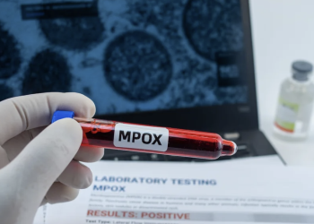 Ευλογιά των πιθήκων: Πώς μεταδίδεται και ποιοί κινδυνεύουν