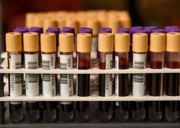 Δίνουμε αίμα και το καλοκαίρι – Εθελοντική αιμοδοσία στις 30 και 31 Ιουλίου στο μετρό Συντάγματος