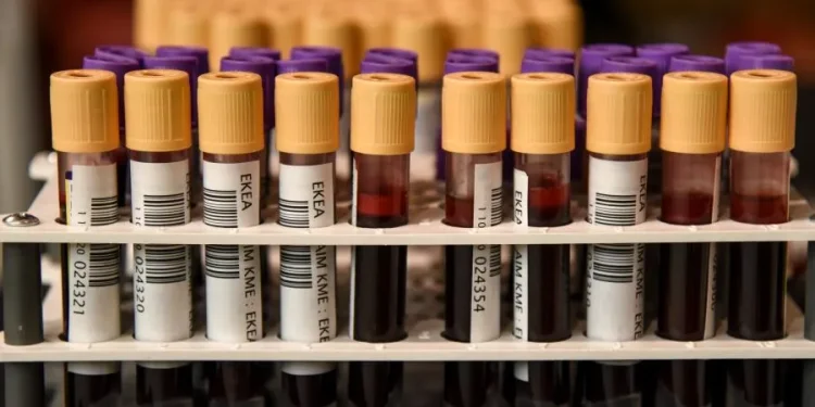 Δίνουμε αίμα και το καλοκαίρι – Εθελοντική αιμοδοσία στις 30 και 31 Ιουλίου στο μετρό Συντάγματος Δίνουμε αίμα και το καλοκαίρι – Εθελοντική αιμοδοσία στις 30 και 31 Ιουλίου στο μετρό Συντάγματος