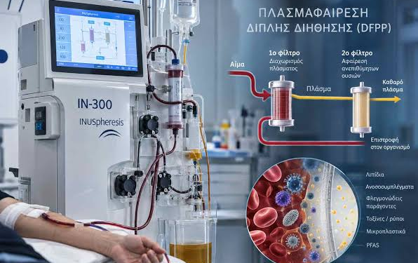 ΤΙ ΕΙΝΑΙ ΚΑΙ ΠΟΣΟ ΚΑΝΕΙ ΤΟ ΠΕΡΙΒΟΗΤΟ ΜΗΧΑΝΗΜΑ ΠΛΑΣΜΑΦΑΙΡΕΣΗΣ ΤΙ ΕΙΝΑΙ ΚΑΙ ΠΟΣΟ ΚΑΝΕΙ ΤΟ ΠΕΡΙΒΟΗΤΟ ΜΗΧΑΝΗΜΑ ΠΛΑΣΜΑΦΑΙΡΕΣΗΣ